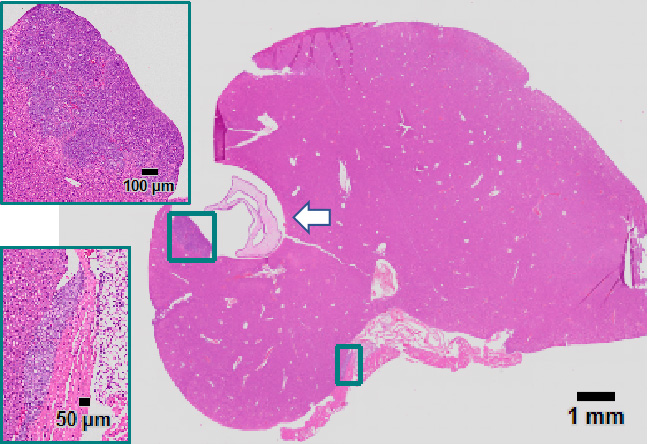 In Vivo Diagnosis of Micro Tumors in Mice